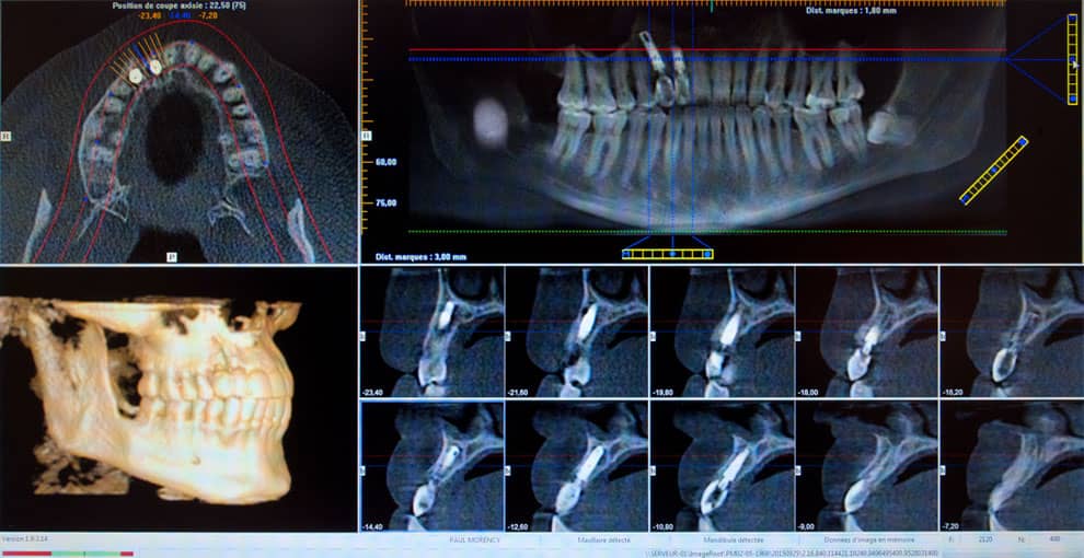 radiographie-3d